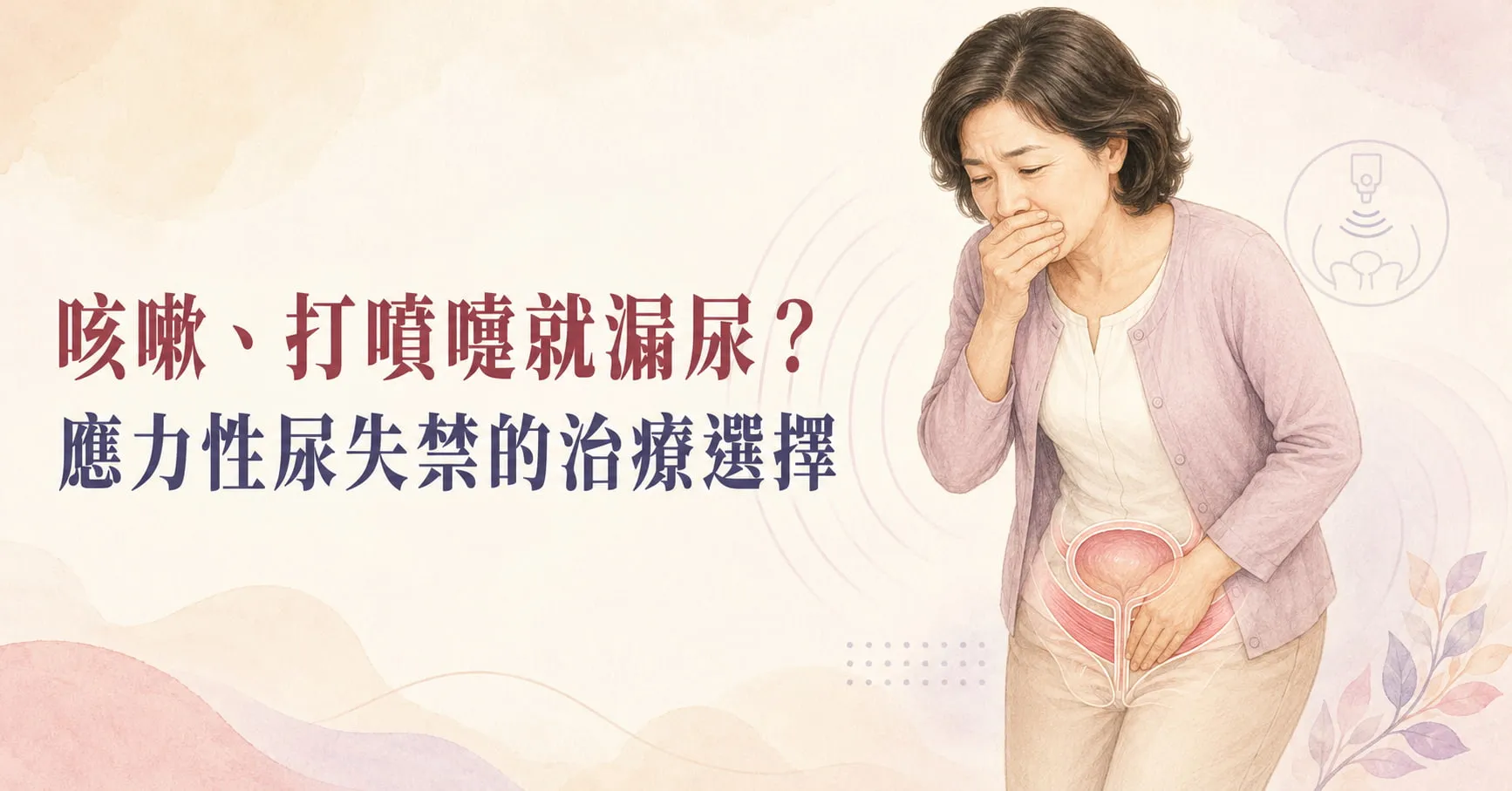 應力性尿失禁治療階梯｜從凱格爾運動、磁波椅到尿道水凝膠充填